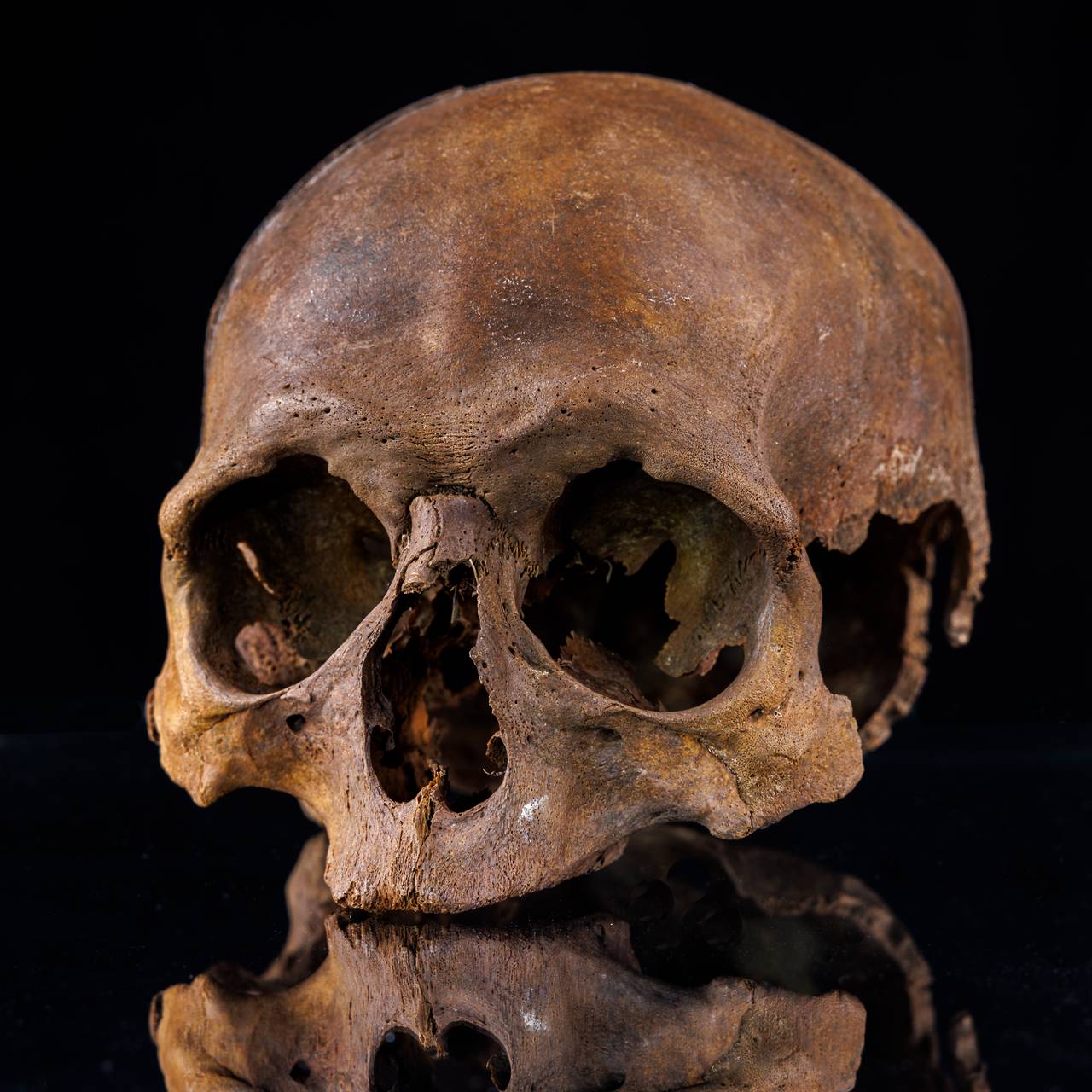 Von Bürgern Söldnern und Chirurgen: Zus Archäologie des Mittelalters und der frühen Neuzeit in Gifhorn